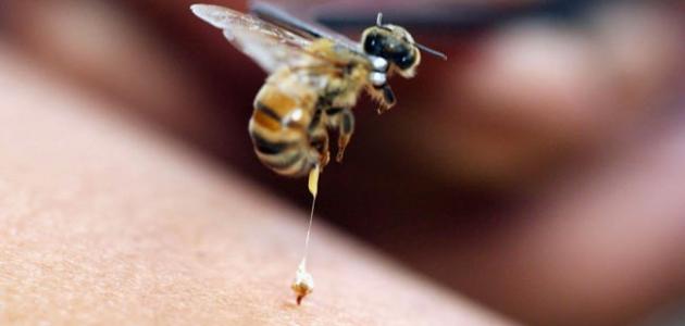 علاج لسعة النحلة بالثوم