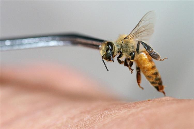 كيفية إعطاء حقن سم النحل