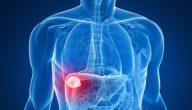 أعراض سرطان الكبد الحميد