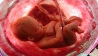 هل حمض الفوليك يسبب إجهاض