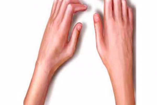 ما هي اعراض الروماتيزم في اليد