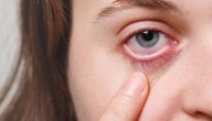 علاج ضعف البصر بالبصل
