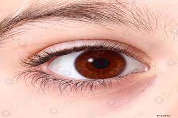 أعراض التهاب قرنية العين